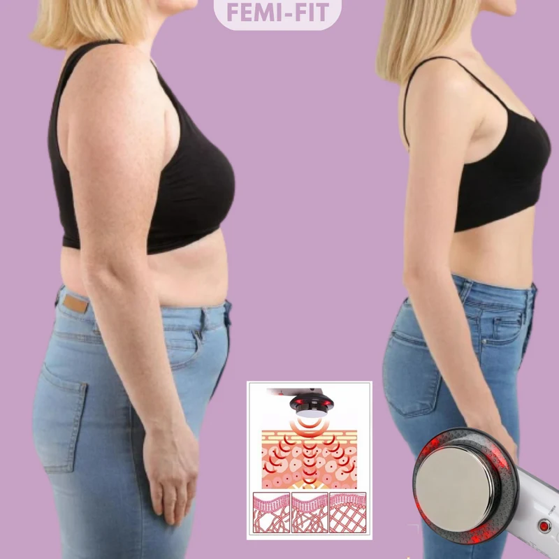 3-i-1 Fedt- og Cellulitisfjerner – SlimFit Pro