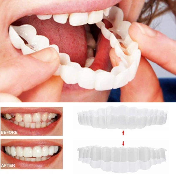 Strålende Smile Veneers til en perfekt tandlinje
